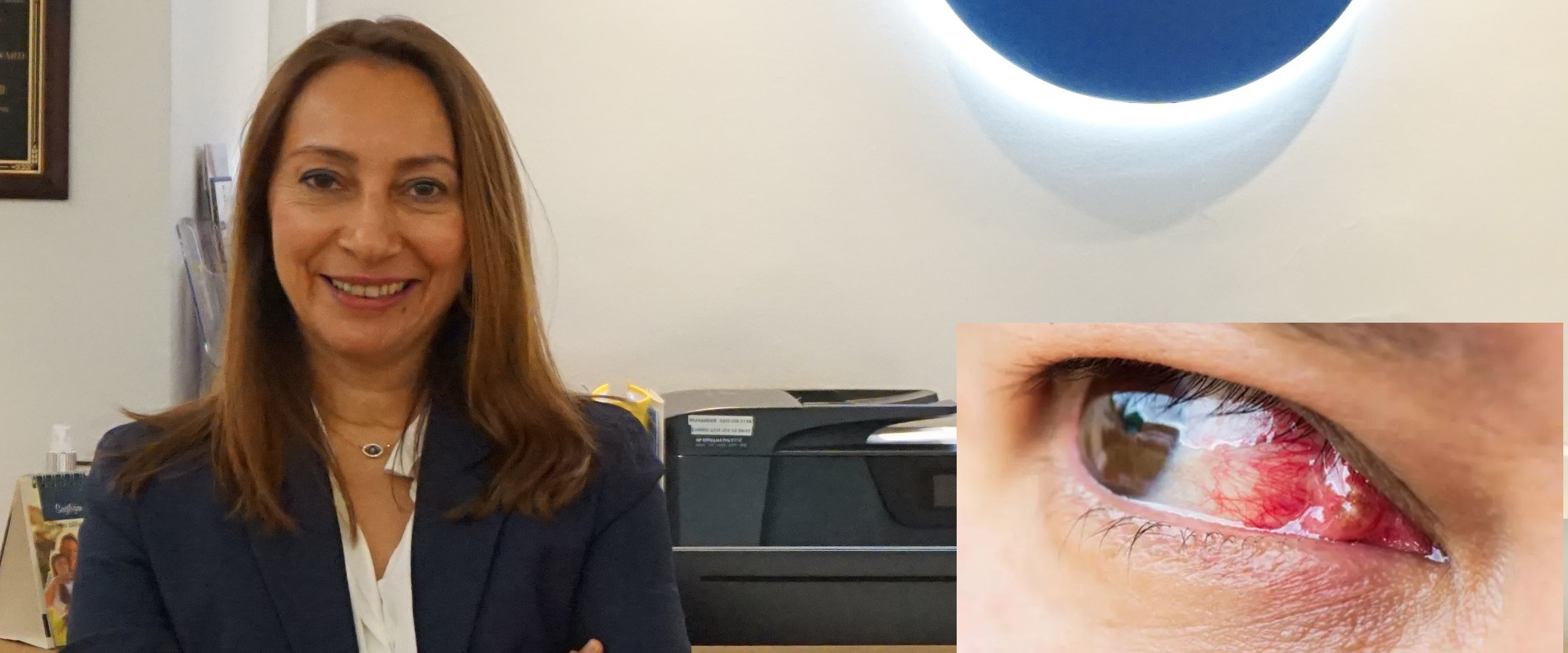 Gözün Doğal Görünümünü Bozan Hastalık Pterjium